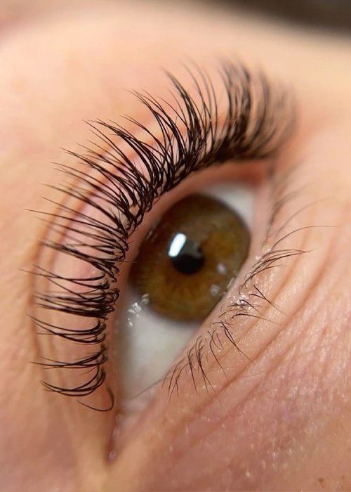 کاشت مژه کلاسیک