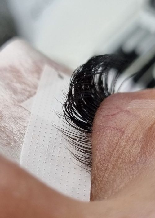 ایزوله سازی مژه